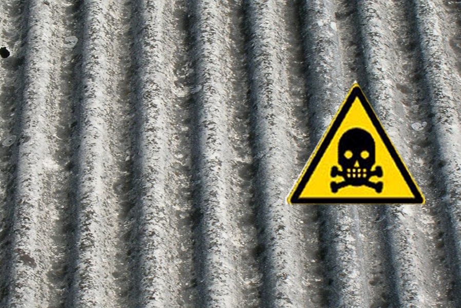 Fibre di amianto nel fegato di pazienti di Casale con colangiocarcinoma