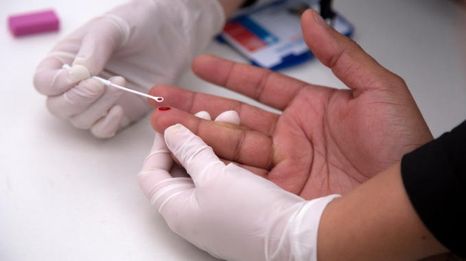 Piemonte: in calo nuove infezioni da HIV