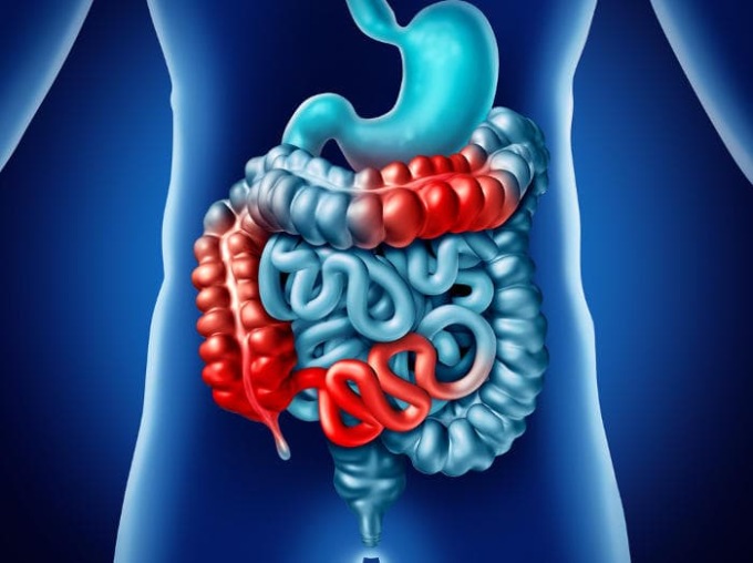 Arriva in Piemonte la campagna per sensibilizzare sulla malattia di Crohn