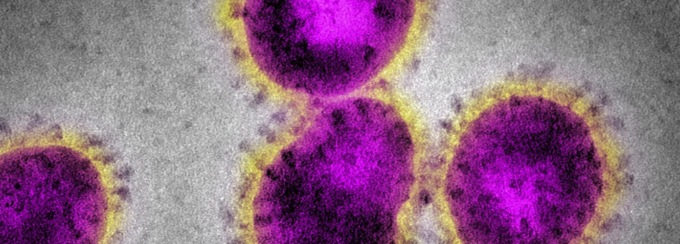 Imprese e sindacati sul Coronavirus: “Importante lavorare insieme”