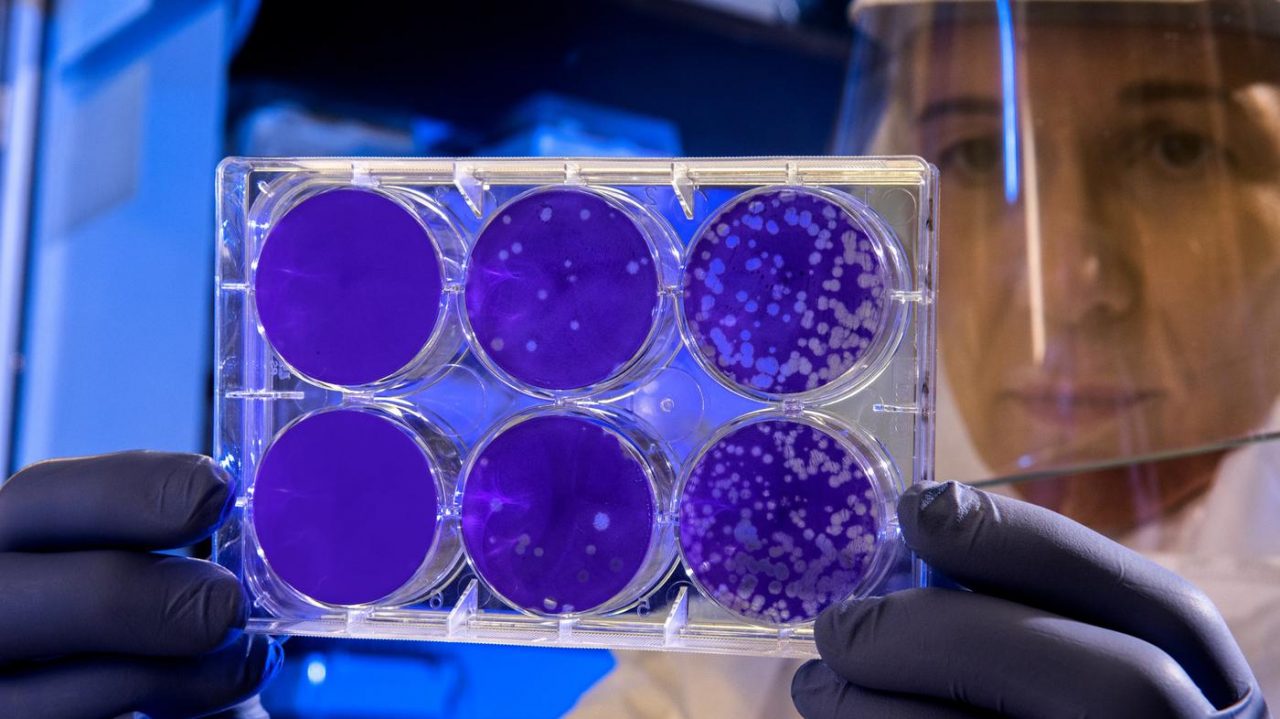 Coronavirus: negativi i test sulla coppia proprietaria di un residence a Tortona