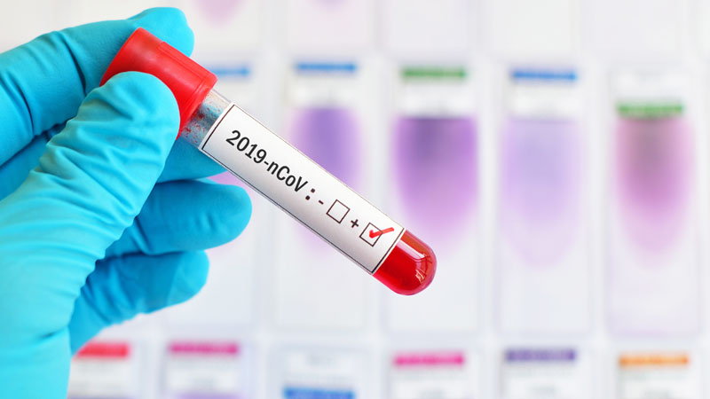 Coronavirus Piemonte, il paziente uno è di nuovo positivo