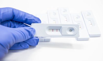 Sviluppato da UniTo il primo test rapido antigenico per captare il virus della PSA