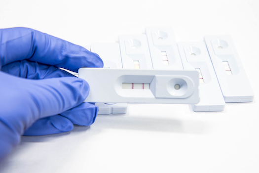 Pronti i kit per eseguire in house i tamponi per il Coronavirus
