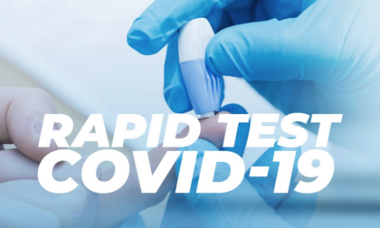 Test sierologici ad Alessandria: dove effettuarli?