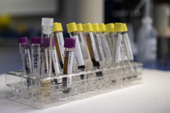 Coronavirus: crescita lieve dei domiciliati a Novi Ligure