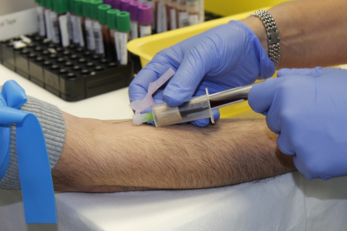 Manca sangue in Piemonte a causa della pandemia: l’appello della Regione
