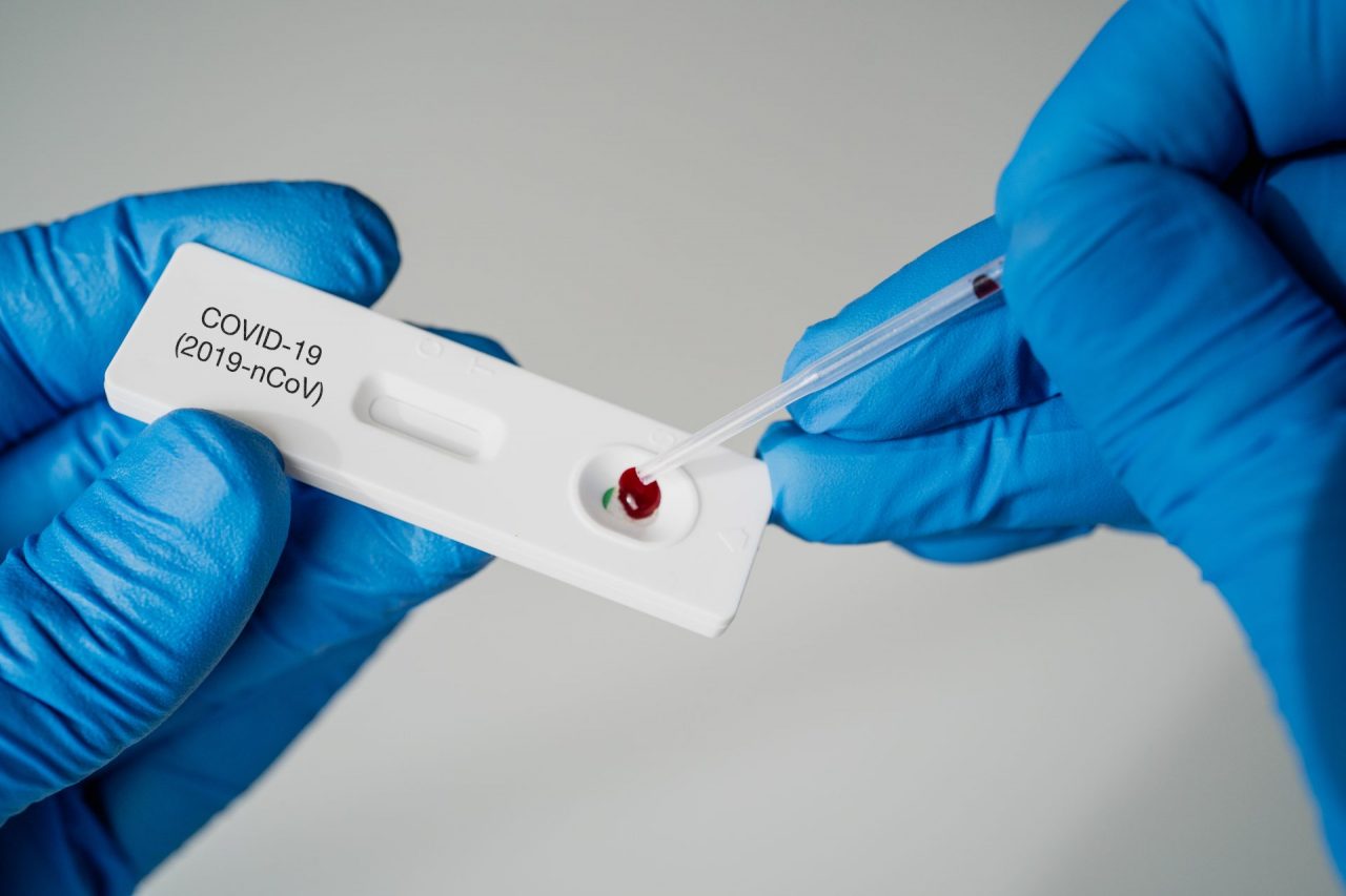 Obbligo Green Pass: nel weekend tamponi rapidi a pagamento negli hotspot pubblici