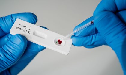 Obbligo Green Pass: nel weekend tamponi rapidi a pagamento negli hotspot pubblici