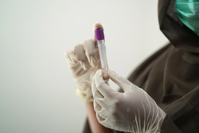 Coronavirus: 7 domiciliati in meno ad Alessandria