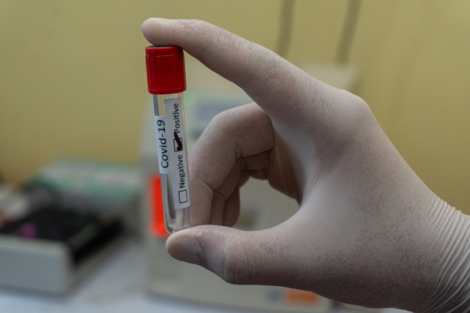 Coronavirus, Piemonte: 153 nuovi casi e nessun decesso