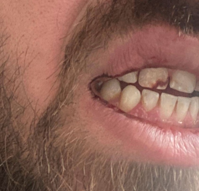 Torino, aggressione in carcere, Osapp: “No slogan ma fatti dalla politica”