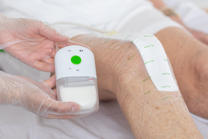 Terapia a pressione negativa per la cura delle ferite