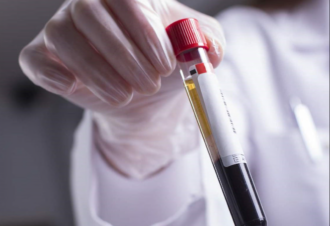 Pfas nel sangue di chi vive vicino al polo chimico? Biomonitoraggio a Spinetta